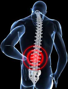 Back pain image