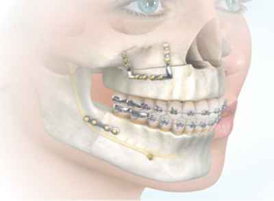 Facial Dental injury image