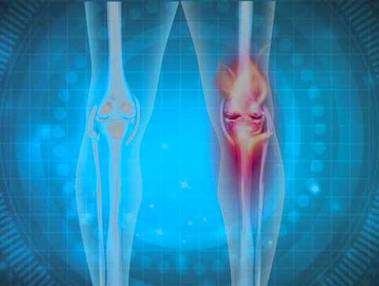 Muscle and soft tissue injury image